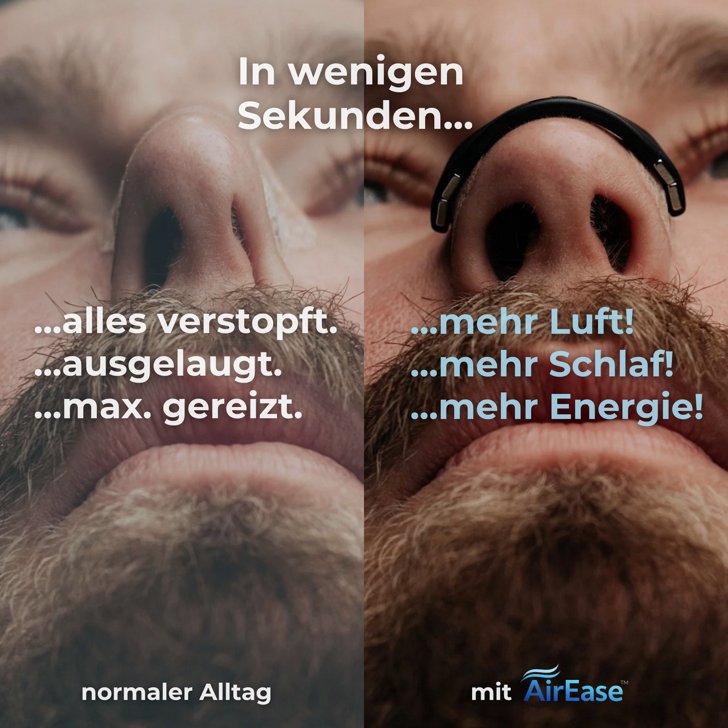 AirEase™ Nasenclip
