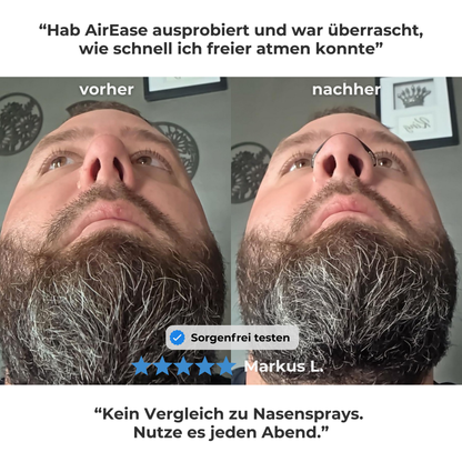 AirEase™ Nasenclip