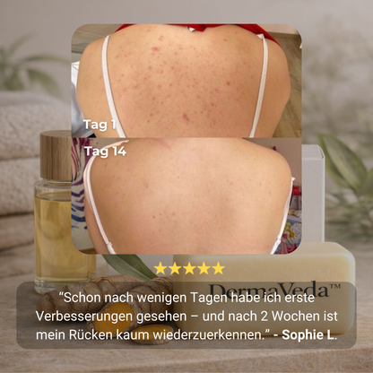 DermaVeda™